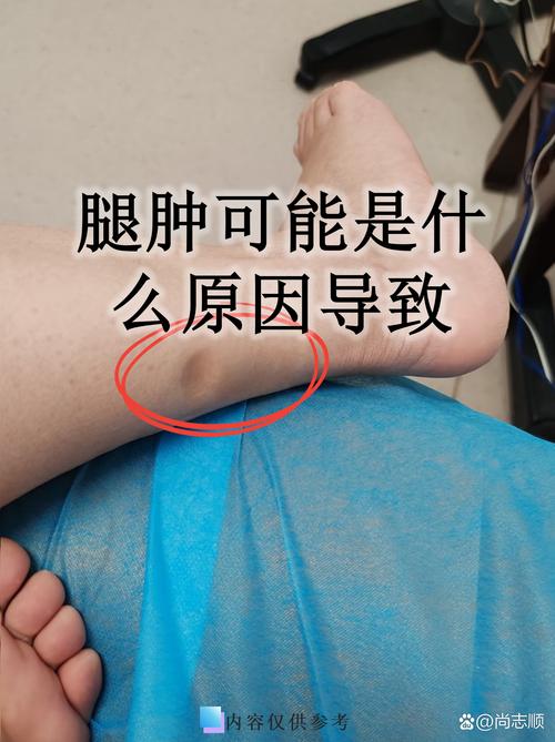 大腿松垮垮的怎么塑型_大腿比较好看的女明星_大腿松弛的女明星